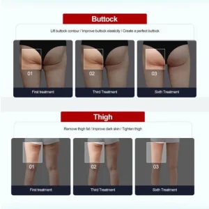 Aparat LCD Drenaj limfatic, EMS,Infrarosu Profesional de Slabit Presoterapie, Pierdere in Greutate, Anti Celulita, Detox Body Spa Silver