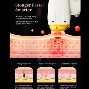 Aparat Epilare Definitiva IcePlatinium Diode Laser 1200W - 50.000.000 impulsuri